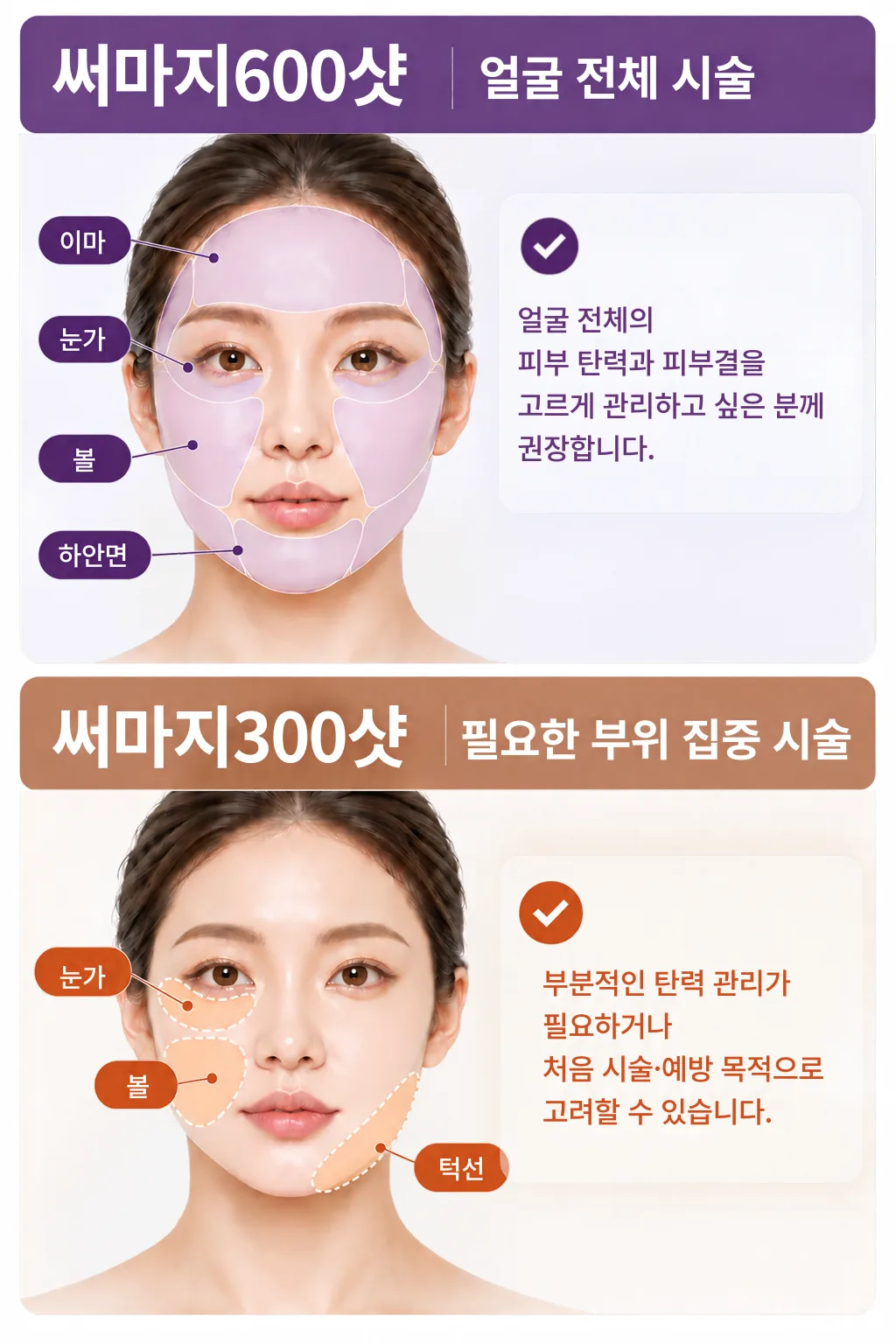 써마지 600샷은 이마·눈가·볼·하안면을 포함한 얼굴 전체, 300샷은 눈가·볼·턱선 등 필요한 부위에 집중해 시술하는 범위를 표시한 그림